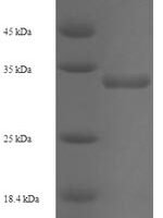 Human Thioredoxin domain-containing protein 12 (TXNDC12) Recombinant Protein - BioCrest Sci