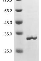 Mouse Neuronal acetylcholine receptor subunit alpha-7 (Chrna7) (C212A, C213A), partial Recombinant Protein - BioCrest Sci