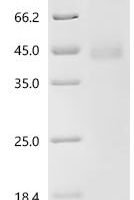 Feline herpesvirus 1 Envelope glycoprotein B (UL27), partial Recombinant Protein - BioCrest Sci