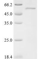 Human Protein PRRC1 (PRRC1) Recombinant Protein - BioCrest Sci