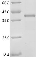 Mouse Fibroblast growth factor 8 (Fgf8) Recombinant Protein, C-His - BioCrest Sci