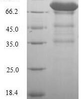 Human Lymphocyte activation gene 3 protein (LAG3), partial Recombinant Protein - BioCrest Sci