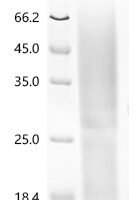 Pig Parathyroid hormone/parathyroid hormone-related peptide receptor (PTH1R), partial Recombinant Protein, C-His, aa 27–184, Yeast - BioCrest Sci
