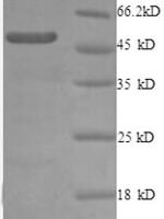 Human 60S ribosomal protein L10a (RPL10A), partial Recombinant Protein - BioCrest Sci