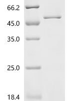 Mouse Procollagen C-endopeptidase enhancer 2 (Pcolce2) Recombinant Protein, C-His - BioCrest Sci