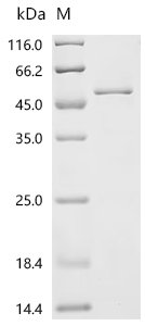 Mouse Procollagen C-endopeptidase enhancer 2 (Pcolce2) Recombinant Protein, C-His, Mus musculus (Mouse), E.coli, C-terminal 6xHis-tagged, 50.1 kDa, purity >≥ 90% as determined by SDS-PAGE.