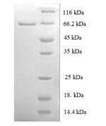 Human Origin recognition complex subunit 4 (ORC4) Recombinant Protein - BioCrest Sci