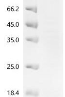 Human papillomavirus type 18 Minor capsid protein L2 (L2), partial Recombinant Protein - BioCrest Sci