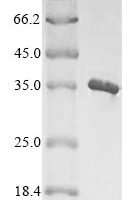 Staphylococcus aureus Poly-beta-1,6-N-acetyl-D-glucosamine N-deacetylase (icaB) Recombinant Protein - BioCrest Sci