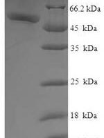 Human Galactose mutarotase (GALM) Recombinant Protein - BioCrest Sci