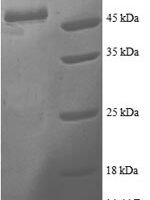Human Proteasome activator complex subunit 2 (PSME2) Recombinant Protein - BioCrest Sci