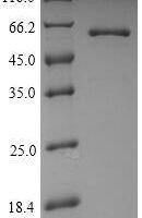 Helicobacter pylori Urease subunit beta (ureB) Recombinant Protein, N-His, aa 1–569, Yeast - BioCrest Sci