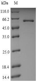 Helicobacter pylori Urease subunit beta (ureB) Recombinant Protein, N-His, aa 1–569, Yeast, Helicobacter pylori (strain ATCC 700392 / 26695) (Campylobacter pylori), Yeast, N-terminal 6xHis-tagged, 63.7 kDa, purity >≥ 90% as determined by SDS-PAGE.