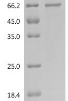 Human Extracellular serine/threonine protein kinase FAM20C (FAM20C) Recombinant Protein, N-10His/C-Myc, aa 93–584, E.coli - BioCrest Sci