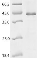 Mouse Histone-lysine N-methyltransferase EZH2 (Ezh2), partial Recombinant Protein - BioCrest Sci