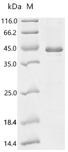 Mouse Histone-lysine N-methyltransferase EZH2 (Ezh2), partial Recombinant Protein, Mus musculus (Mouse), E.coli, C-terminal 6xHis-tagged, 41.6 kDa, purity >≥ 85% as determined by SDS-PAGE.