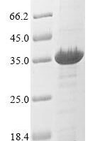 Staphylococcus aureus Tetracycline resistance protein tetM (tetM), partial Recombinant Protein - BioCrest Sci