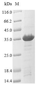 Staphylococcus aureus Tetracycline resistance protein tetM (tetM), partial Recombinant Protein, Staphylococcus aureus, E.coli, N-terminal 10xHis-tagged and C-terminal Myc-tagged, 32.1 kDa, purity >≥ 85% as determined by SDS-PAGE.