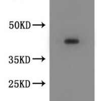 Macaca fascicularis Chemokine receptor 8 (CCR8)-VLPs Recombinant Protein - BioCrest Sci