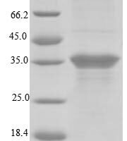 Human Blood group Rh (D) polypeptide (RHD), partial Recombinant Protein, N-His-GST - BioCrest Sci