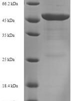 Acinetobacter baumannii Outer membrane protein Omp38 (omp38) Recombinant Protein, N-His-SUMO - BioCrest Sci