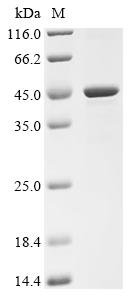 Human ADP-ribosylation factor GTPase-activating protein 1 (ARFGAP1) Recombinant Protein, Homo sapiens (Human), E.coli, C-terminal 6xHis-tagged, 45.5 kDa, purity >≥ 85% as determined by SDS-PAGE.