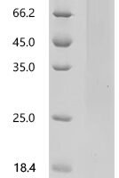 Mouse Cerebellin-4 (Cbln4) Recombinant Protein, C-His, aa 25–198, Yeast - BioCrest Sci