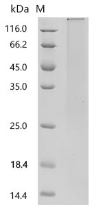Mouse Cerebellin-4 (Cbln4) Recombinant Protein, C-His, aa 25–198, Yeast, Mus musculus (Mouse), Yeast, C-terminal 6xHis-tagged, 20.3 kDa, purity >≥ 90% as determined by SDS-PAGE.