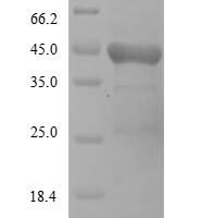Newcastle disease virus Hemagglutinin-neuraminidase (HN),Partial Recombinant Protein - BioCrest Sci