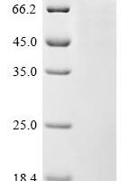 Human DNA topoisomerase 1 (TOP1) Recombinant Protein - BioCrest Sci