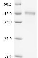 Rat Zinc transporter ZIP6 (Slc39a6), partial Recombinant Protein, C-His - BioCrest Sci
