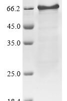 Human Interferon regulatory factor 7 (IRF7) Recombinant Protein - BioCrest Sci