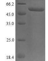 Human Protein disulfide-isomerase (P4HB), partial Recombinant Protein, N-His/C-10His - BioCrest Sci