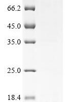 Human Type-1 angiotensin II receptor (AGTR1), partial Recombinant Protein, N-10His/C-Myc - BioCrest Sci
