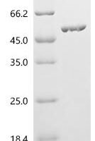 Streptococcus agalactiae C protein beta antigen (bac), partial Recombinant Protein - BioCrest Sci