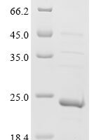 Tobacco mosaic virus Capsid protein (CP) Recombinant Protein, N-His - BioCrest Sci