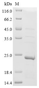 Tobacco mosaic virus Capsid protein (CP) Recombinant Protein, N-His, Tobacco mosaic virus (strain O) (TMV), E.coli, N-terminal 6xHis-tagged, 21.6 kDa, purity >≥ 85% as determined by SDS-PAGE.
