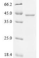 Human Serine/threonine-protein phosphatase 2A catalytic subunit alpha isoform (PPP2CA) Recombinant Protein, C-His - BioCrest Sci
