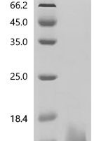 Human Platelet factor 4 (PF4) Recombinant Protein, N-His-tagge - BioCrest Sci