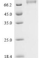 Human Desmoglein-1 (DSG1), partial Recombinant Protein, C-His - BioCrest Sci