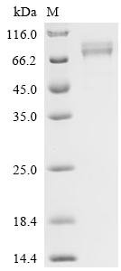 Human Desmoglein-1 (DSG1), partial Recombinant Protein, C-His, Homo sapiens (Human), Mammalian cell, C-terminal 6xHis-tagged, 59.5 kDa, purity >≥ 95% as determined by SDS-PAGE.