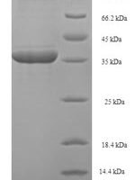 Human Phospholysine phosphohistidine inorganic pyrophosphate phosphatase (LHPP) Recombinant Protein - BioCrest Sci
