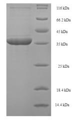 Human Phospholysine phosphohistidine inorganic pyrophosphate phosphatase (LHPP) Recombinant Protein, Homo sapiens (Human), E.coli, N-terminal 6xHis-SUMO-tagged, 45.2 kDa, purity >≥ 90% as determined by SDS-PAGE.