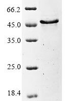 Human herpesvirus 6B Glycoprotein Q1(U100)(X130S,X223S),partial Recombinant Protein - BioCrest Sci