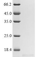 Human Gastric inhibitory polypeptide (GIP) Recombinant Protein - BioCrest Sci