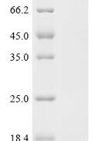 Shigella flexneri Arginine ABC transporter permease protein ArtM (artM), partial Recombinant Protein - BioCrest Sci