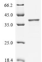 Human Serine/threonine-protein phosphatase PGAM5,mitochondrial (PGAM5), partial Recombinant Protein - BioCrest Sci