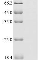 Human T-cell leukemia virus 3 Envelope glycoprotein gp63 (env), partial Recombinant Protein, C-hFc1 - BioCrest Sci