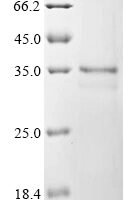 Mouse High mobility group protein B1 (Hmgb1), partial Recombinant Protein - BioCrest Sci