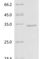 Coxiella burnetii Chaperonin GroEL (groEL), partial Recombinant Protein, C-His - BioCrest Sci